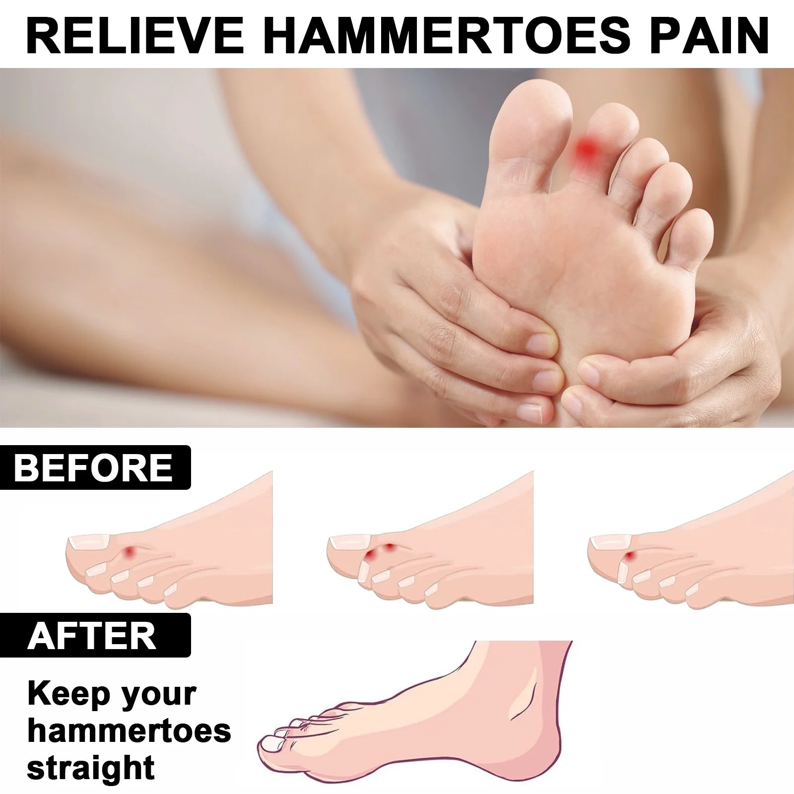 3 Pairs Toe Separators, Correcting Bunions and Restoring Toes to Their Original Shape, Toe Spacers Bunion Corrector, for Men and Women