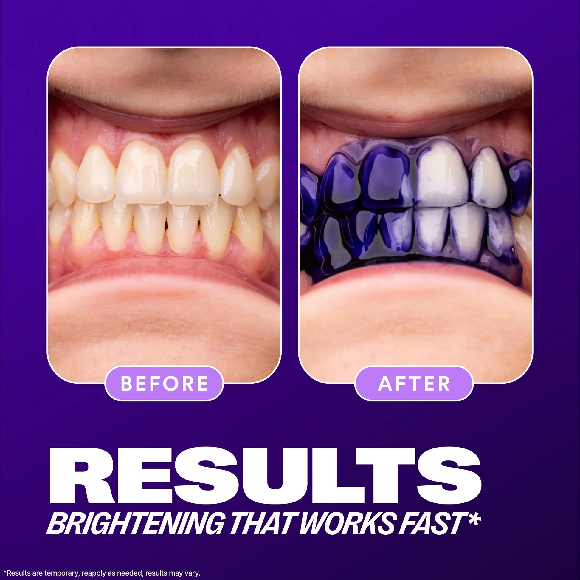 V34 Colour Corrector Serum, Teeth Whitening