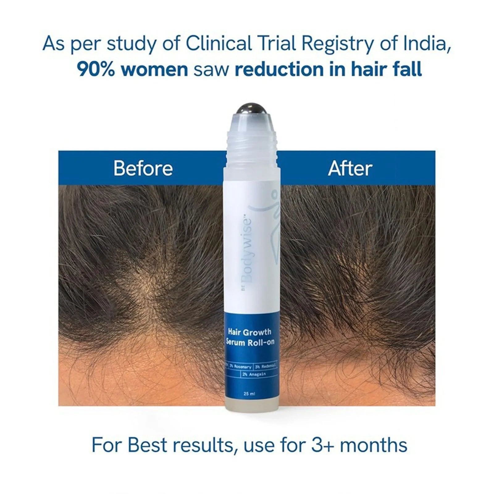 Be - Bodywise 3% Rosemary Hair Growth Serum (Roll On) | Thicker & Stronger Hair | Prevents Hair Fall & Stimulates Hair Follicles | for All Hair Types | 25Ml Makeup Organizers